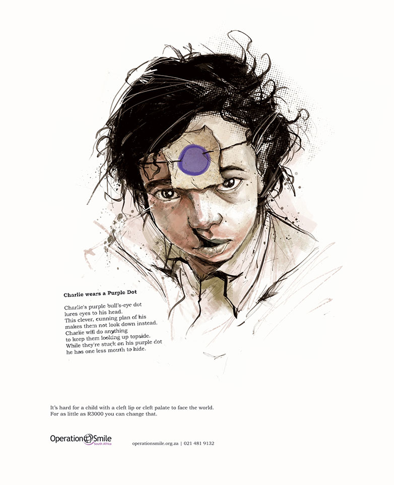 25 inspiring not-for-profit ads 13_1.-OperationSmile_Charlie