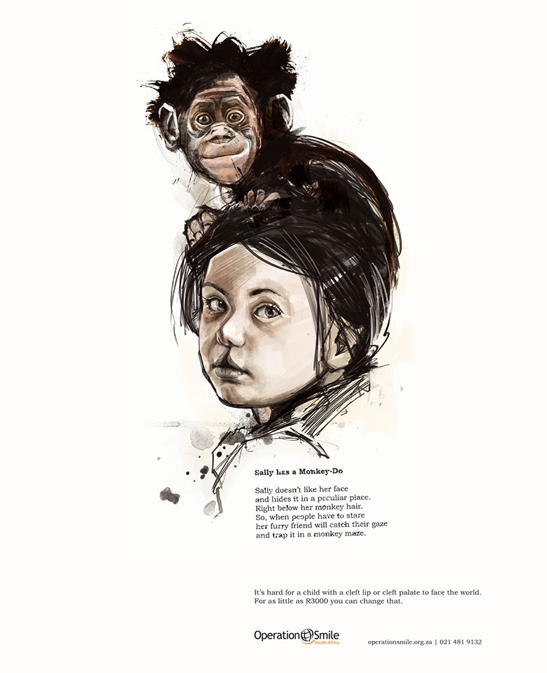 25 inspiring not-for-profit ads 13.-OperationSmile_Sally
