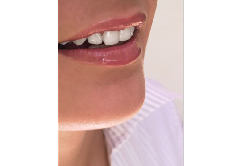 25+ must-have Photoshop actions for your toolkit teeth-whitening